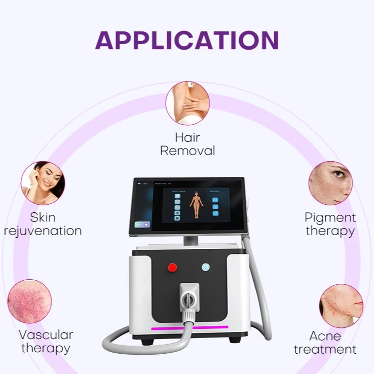 IPLtreatment IPLtreatment
